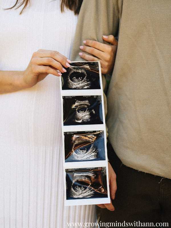 Couple-holding-ultrasound-result-in-memorable-first-baby-announcement-ideas-to-tell-your-big-news.
